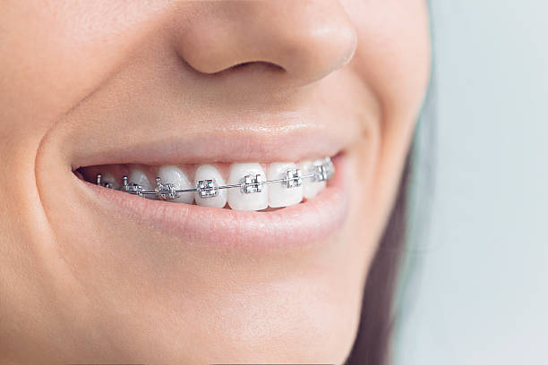 Best Wisdom Tooth Removal  in Leonard, TX